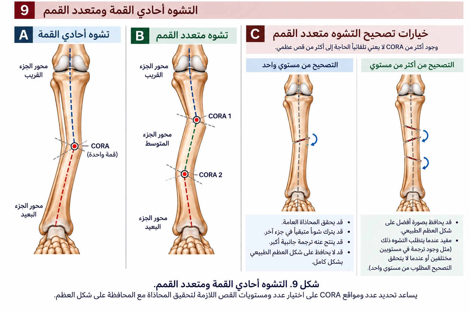مقارنة التشوه أحادي القمة ومتعدد القمم وخيارات التصحيح
