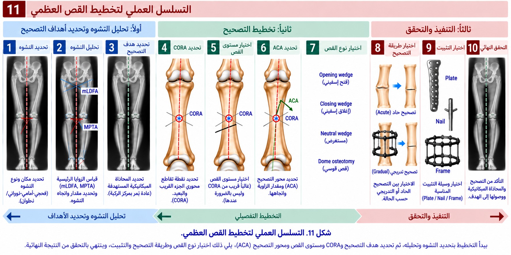 مخطط التسلسل العملي لتخطيط القص العظمي من تحديد التشوه إلى التحقق النهائي