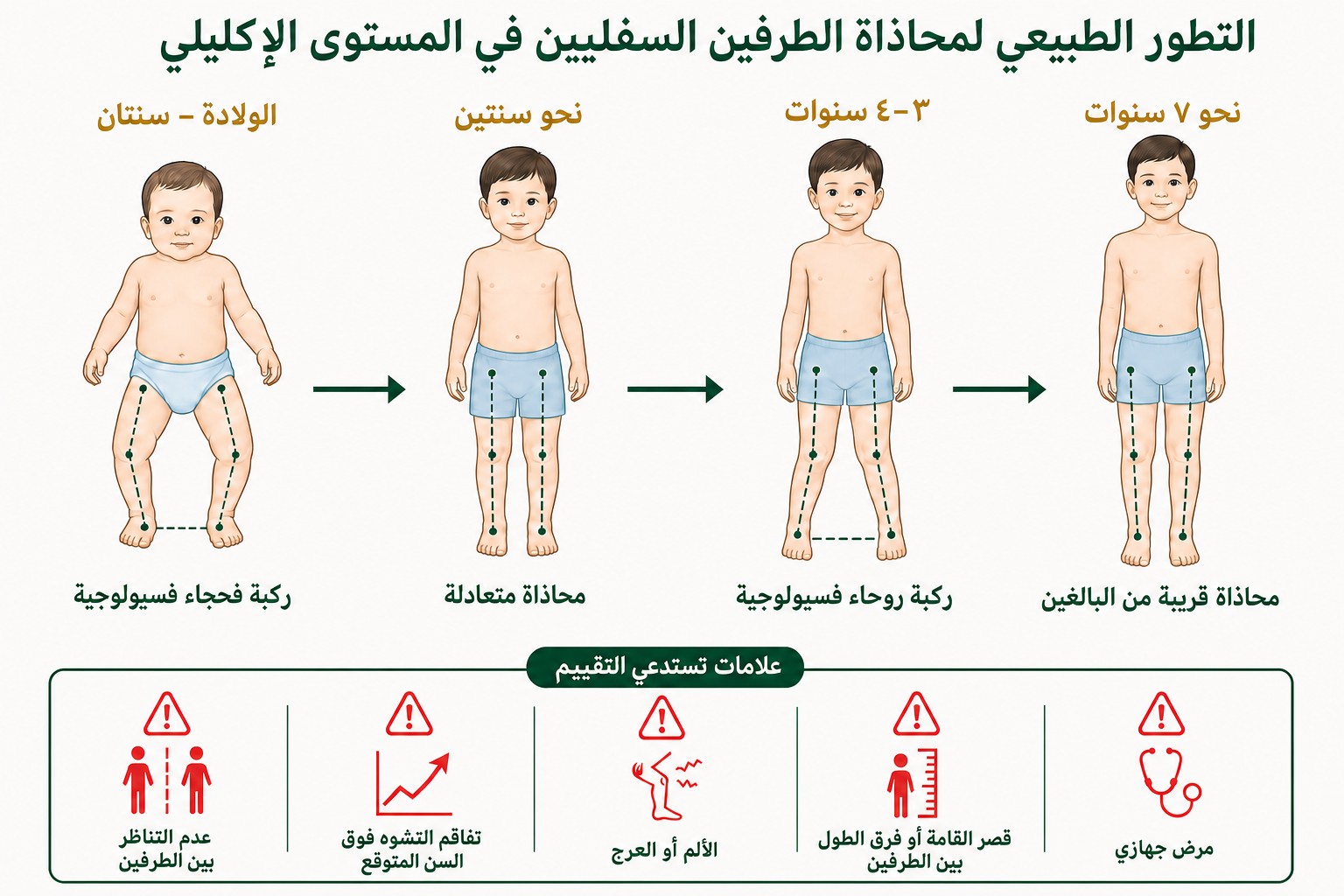 تطور المحاذاة الإكليلية الطبيعية للطرف السفلي مع تقدم عمر الطفل